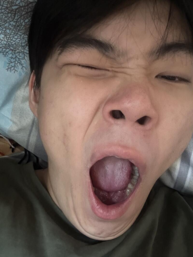 A person with dark hair and an olive shirt is yawning with their mouth wide open, showing their tongue and teeth, and their eyes are squinted shut.